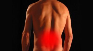 Nerf sciatique : soulager naturellement la douleur efficacement