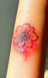 Tatouage Infecté : Que Faire ? Symptômes et Prévention des Complications